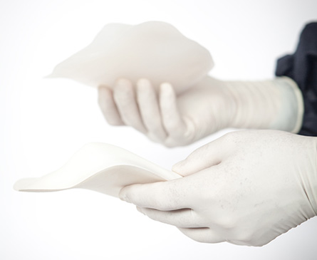 AnatomikModeling mit chirurgischen 3D Implantaten - 3Dnatives