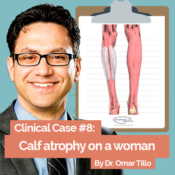 Clinical Case 6: treatment of a woman's calf atrophy with implant
