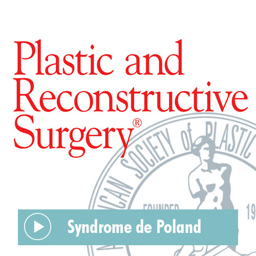 Article du Plastic and Reconstructive Surgery Journal sur le Syndrome de Poland
