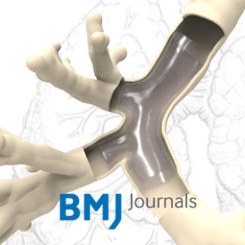 New publication in BMJ Journals about 3D custom-made airway stents