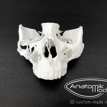  Stampa 3D: nuovo approccio per l&#039;anticipazione in chirurgia