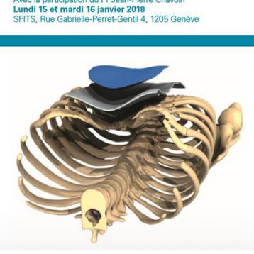 Simposio "Trattamento delle deformità toraciche ", 15-16 gennaio 2018, Ginevra, Svizzera 