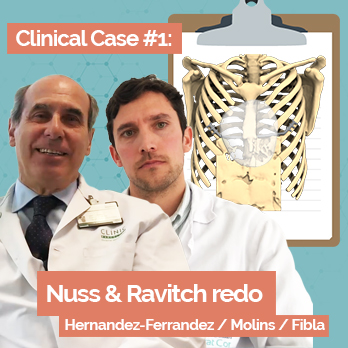 Caso clinico revista de Nuss y Ravitch con implantes 3D a medida por el Pectus