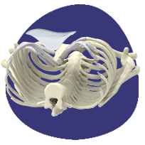 Design 3D d'un implant 3D sur-mesure Design 3D d'un implant 3D sur-mesure