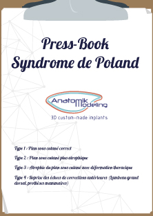 Press-book Syndrome de Poland
