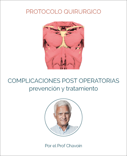 Complicaciones post operatorias de los implantes de tórax 3D hechos a medida: prevención y tratamiento