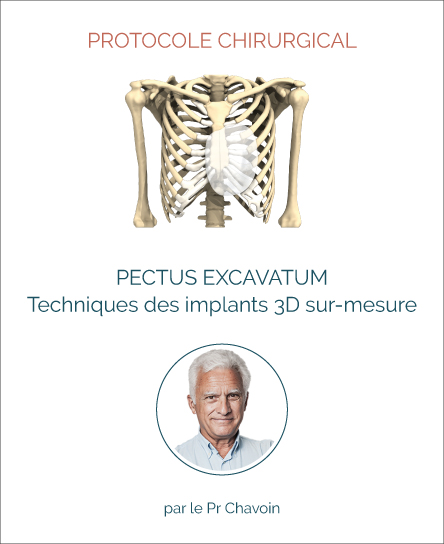 Protocole chirurgie pectus excavatum avec implants