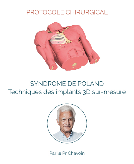 Protocole chirurgie syndrome de Poland avec implant