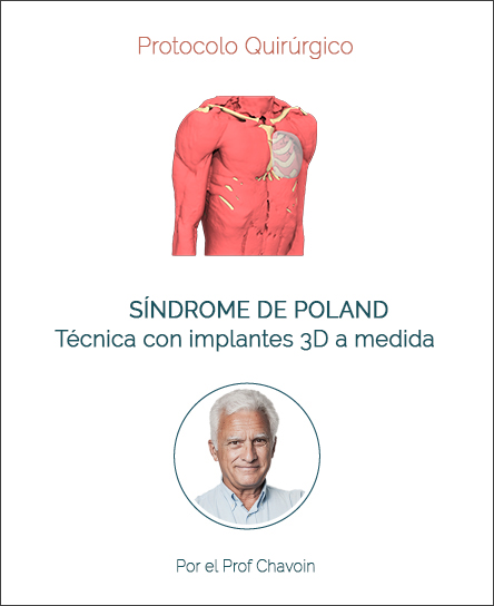 Surgery protocol for Poland Syndrome with implant technique