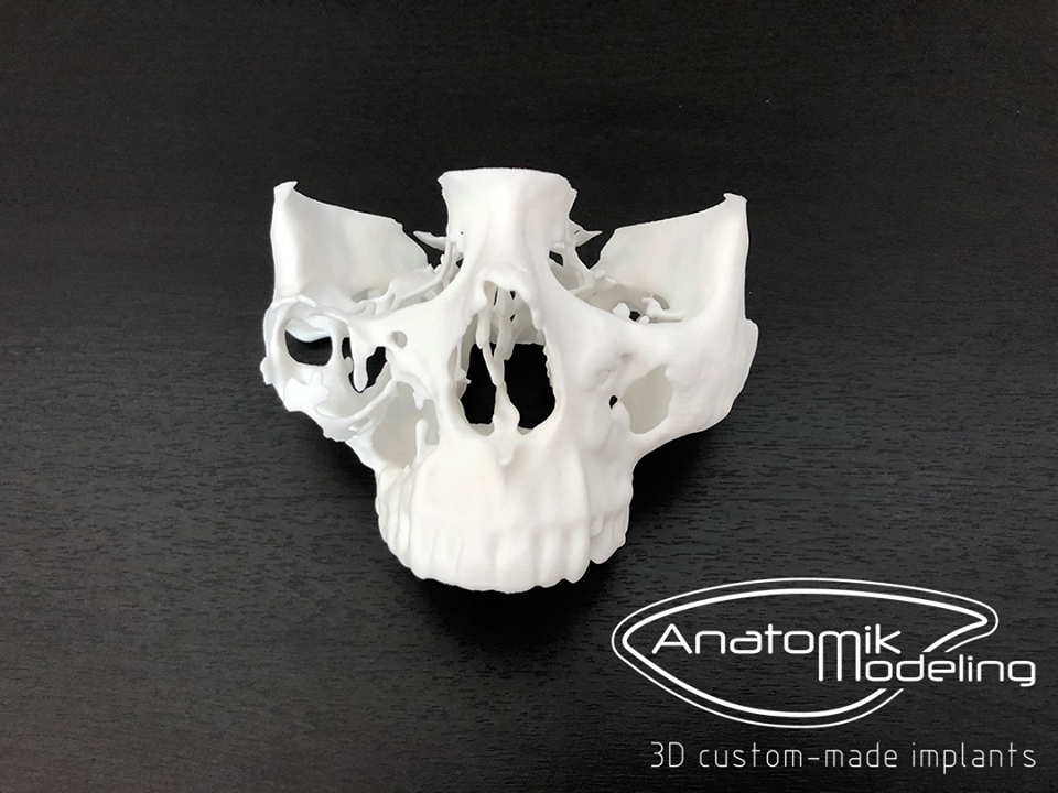  3D-Druck: Neuer Ansatz für die Antizipation in der Chirurgie