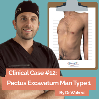 Pectus treatment clinical case by Dr Waked