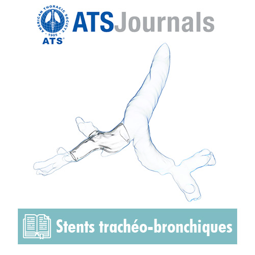 ATS Journal article : Computer-assisted Customized Airway Stent 