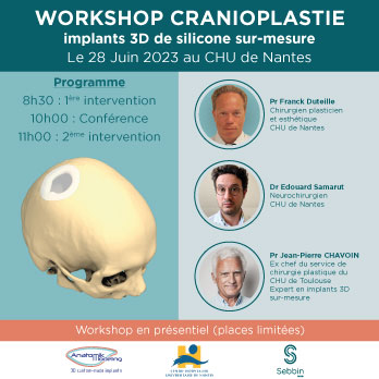 Affiche Workshop Cranioplastie à Nantes le 28 Juin 2023
