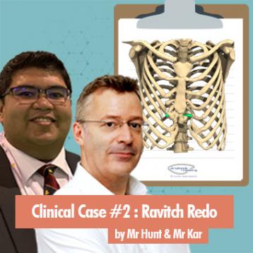 Clinical Case : Modified Ravitch failure on Pectus