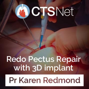 Post-Ravitch Repair by Pr Redmond on CTSnet