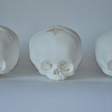 3D printing: New way of training for the skull examination 