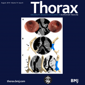 AnatomikModeling&#039;s work on the front cover of Thorax Journal!