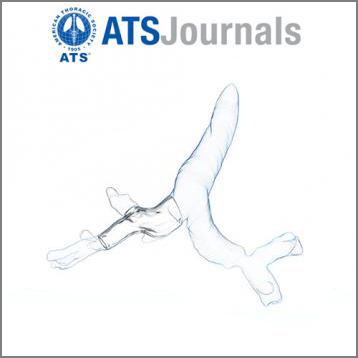 ATS Journal artículo : Computer-assisted Customized Airway Stent 