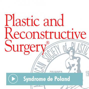 Article du Plastic and Reconstructive Surgery Journal sur le Syndrome de Poland